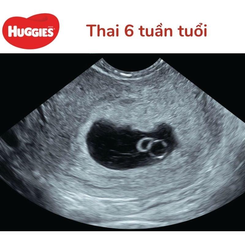 Hình ảnh thể hiện sự cân bằng và phát triển bản thân cho người sinh tháng 4